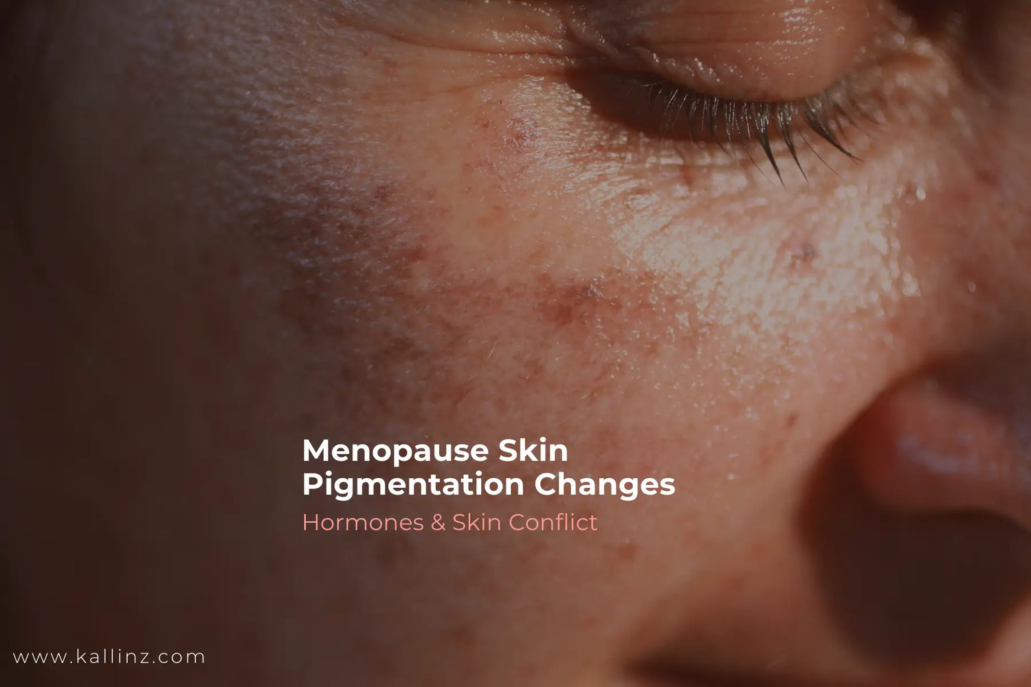 Menopause Skin Pigmentation Changes Blog Cover